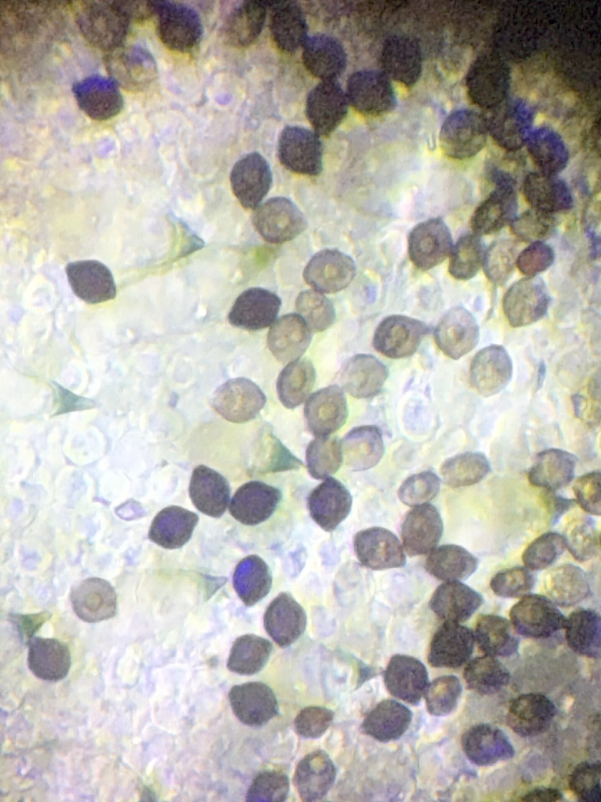 Panaeolus X: Isolate P2(Pan cyan x Pan Bisporus) Research Plate 100mm - Image 5